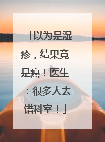 以为是湿疹，结果竟是癌！医生：很多人去错科室！